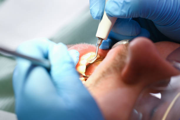 Best Emergency Dental Services for Seniors in Cloverdale, CA