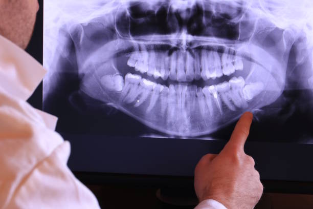Best Emergency Dentist for Special Needs Patients in Cloverdale, CA