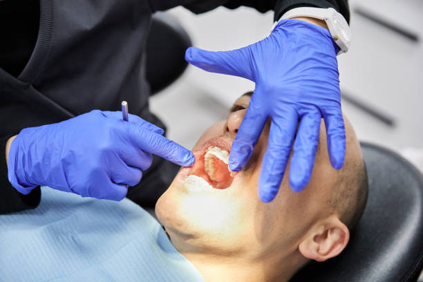 Best Emergency Dentist for Special Needs Patients in Cloverdale, CA