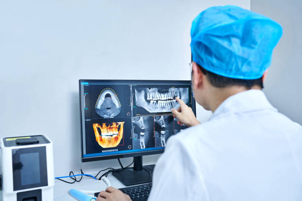 Best Emergency Dental Extractions in Cloverdale, CA